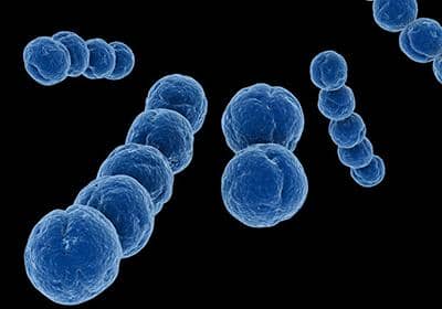 什么是原核蛋白表達系統(tǒng)?它的優(yōu)勢體現(xiàn)在哪些方面?