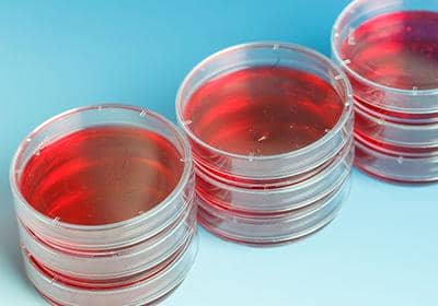 您了解培養(yǎng)基嗎?盤點細胞培養(yǎng)基使用的一些問題