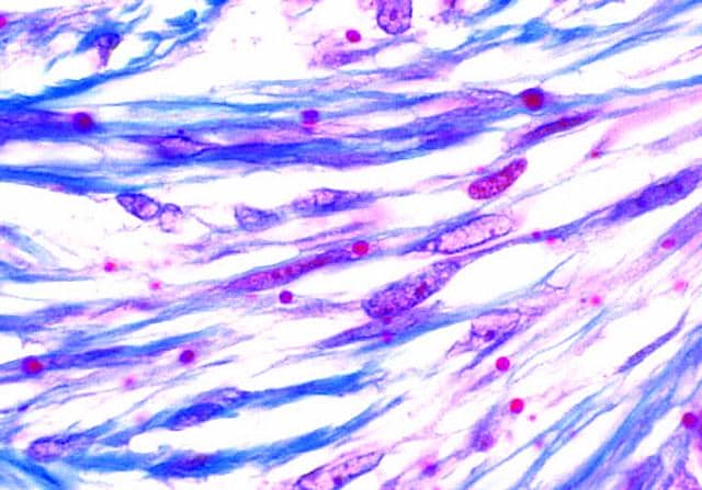面對(duì)蛋白包涵體，我們只能束手無策？
