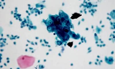 什么雜交瘤抗體測序?它的服務內容有哪些?