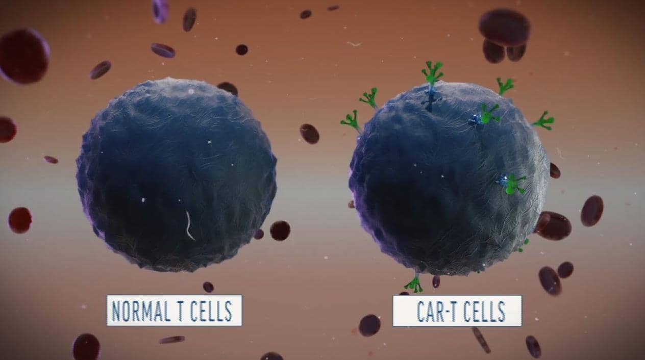 解讀：功能失調的CAR-T細胞的特征