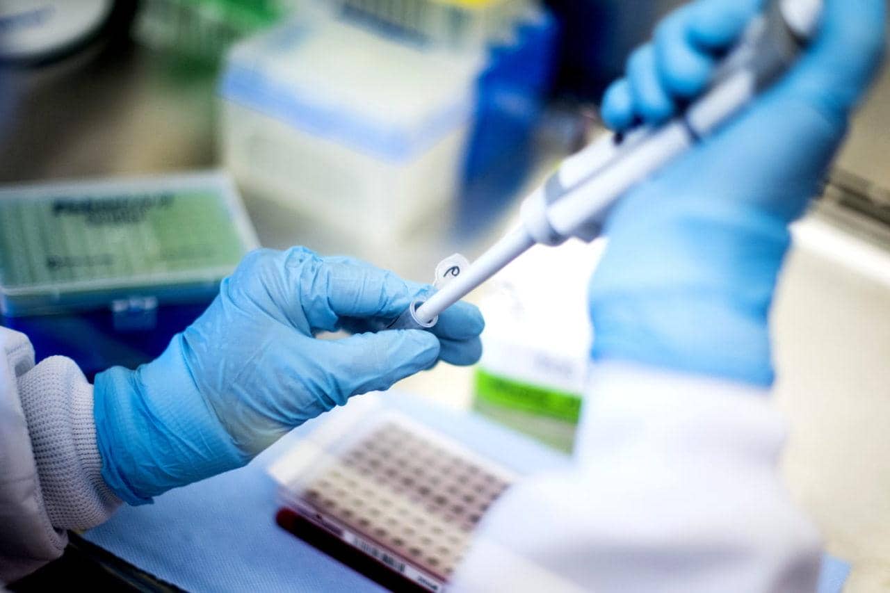 利用兔單B細胞技術快速鑒定具有高親和力和多種表位的抗特異型單克隆抗體