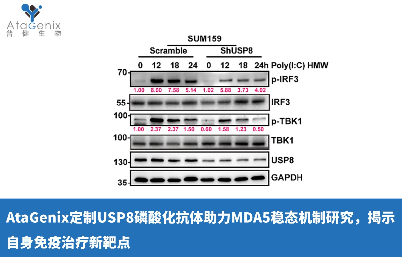 AtaGenix定制USP8磷酸化抗體助力MDA5穩態機制研究，揭示自身免疫治療新靶點