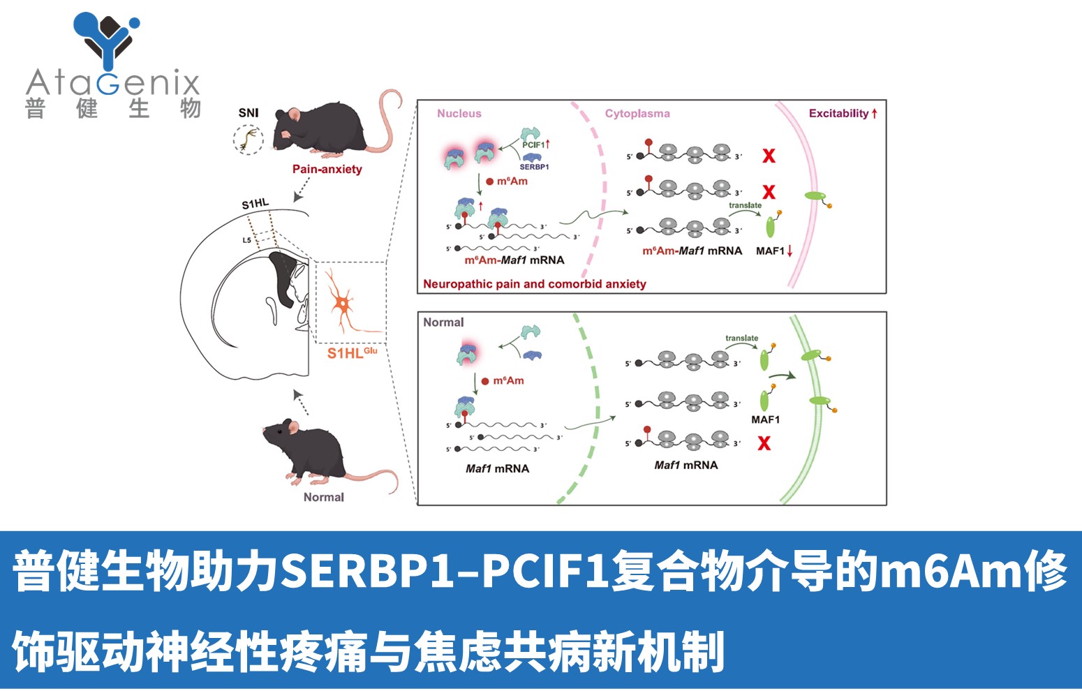 普健生物助力SERBP1–PCIF1復合物介導的m6Am修飾驅動神經性疼痛與焦慮共病新機制