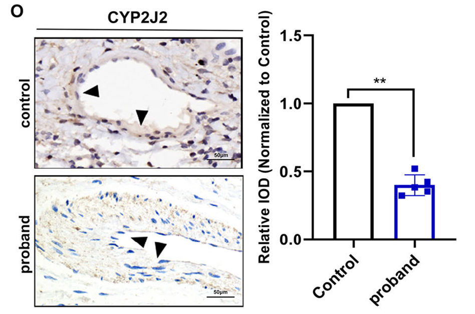 AtaGenix為本研究定制了 CYP2J2 抗體，用于免疫印跡和免疫組化實驗